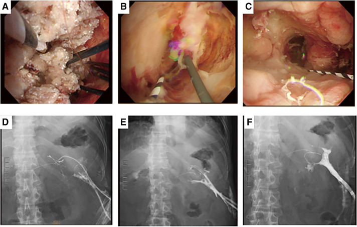 Fig. 6
