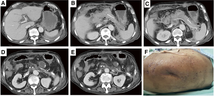 Fig. 7