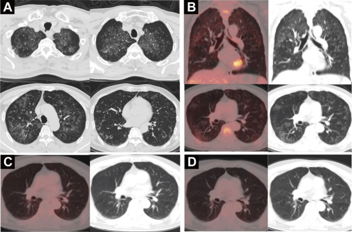 FIGURE 1