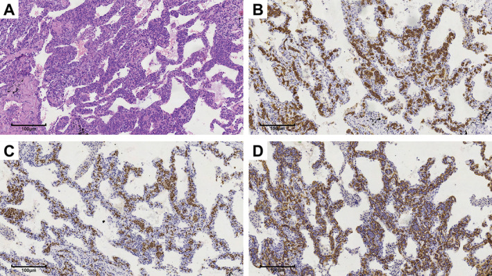 FIGURE 2