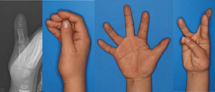Figure 5