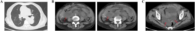Figure 4