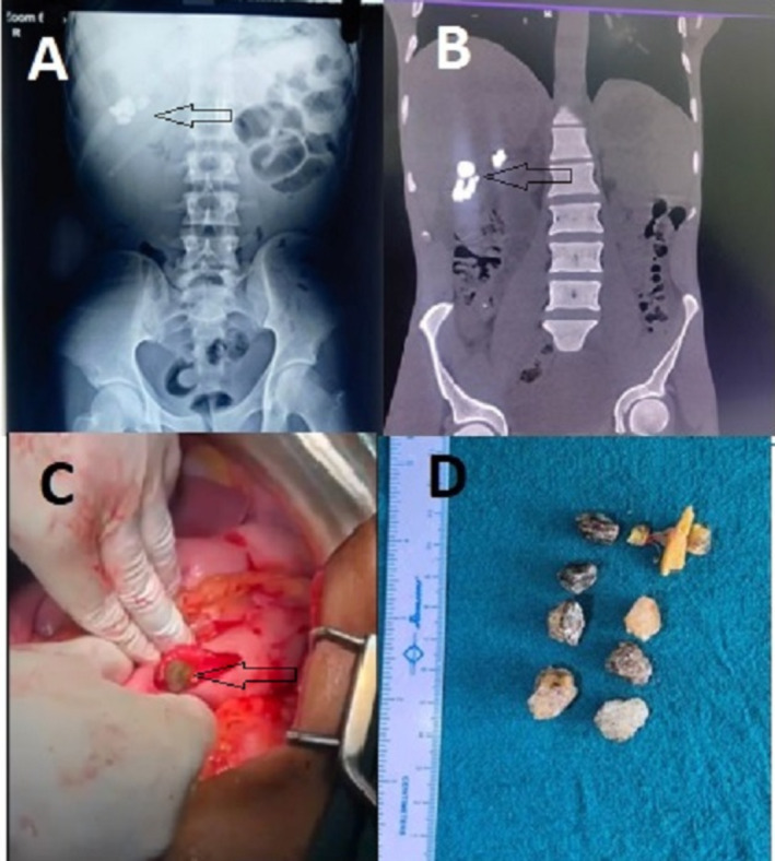 FIGURE 1