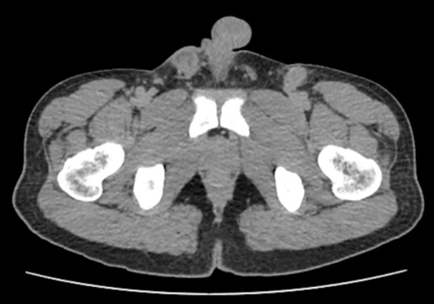 Figure 2