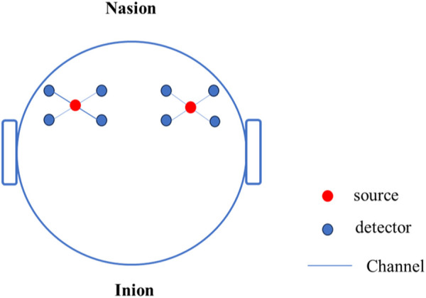 FIGURE 4