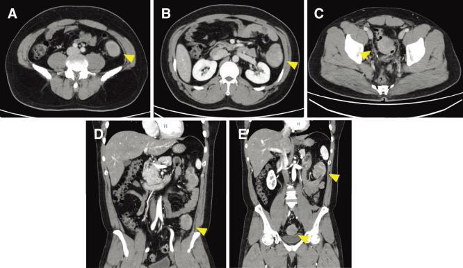 Fig. 2