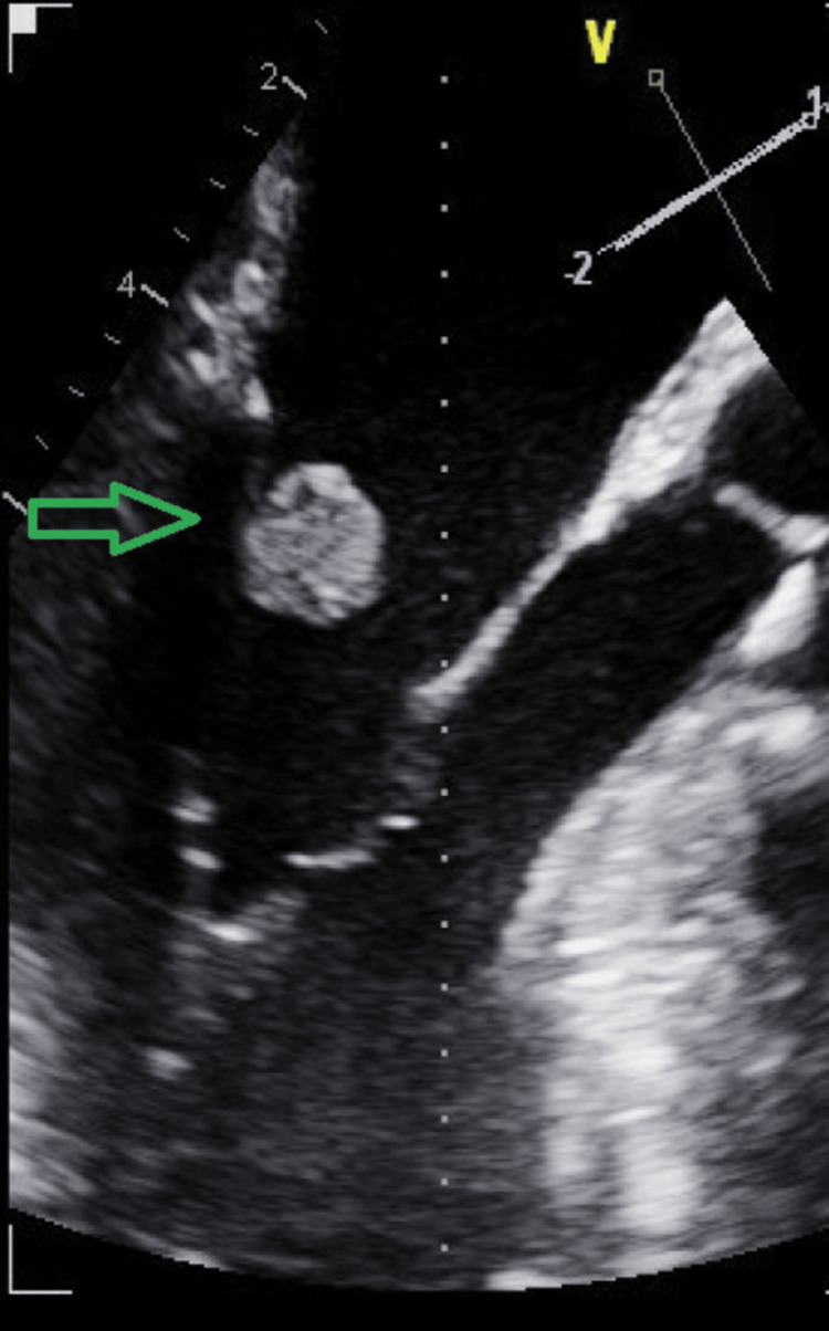 Figure 5