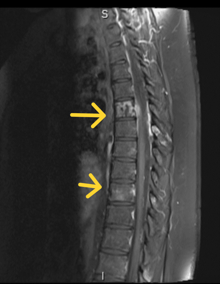 Figure 10
