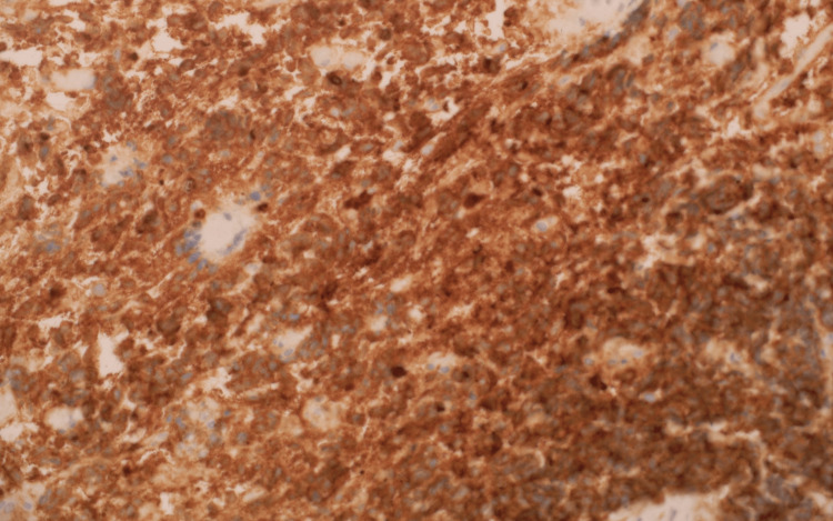 Figure 12
