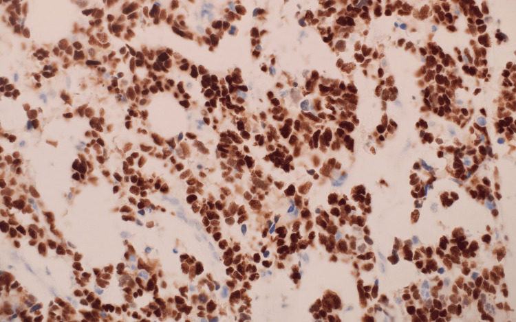 Figure 13