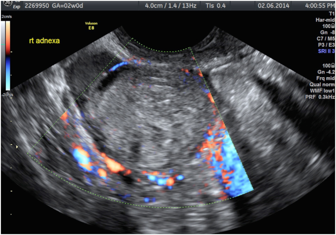 Figure 4