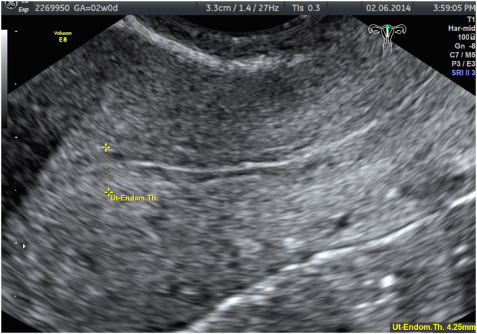 Figure 5