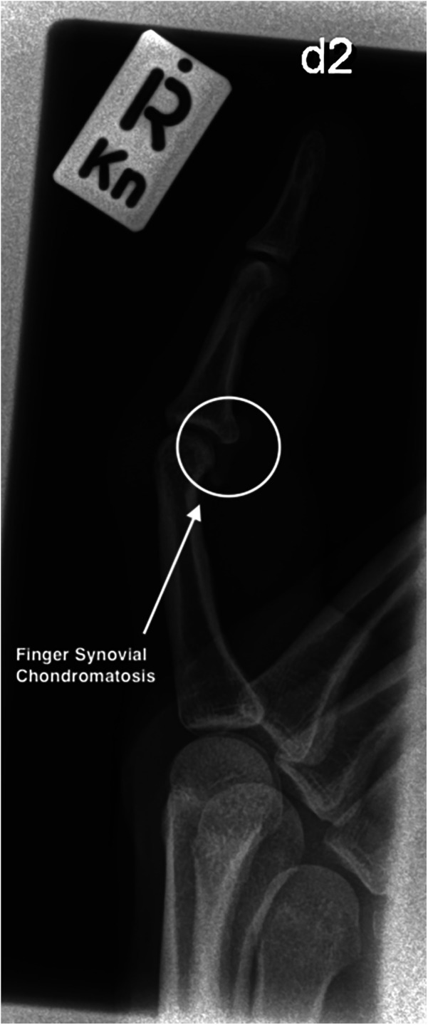 Figure 2