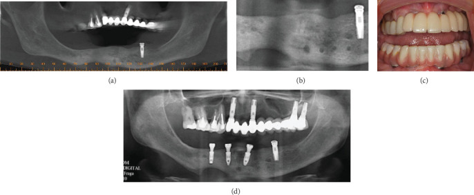 Figure 6