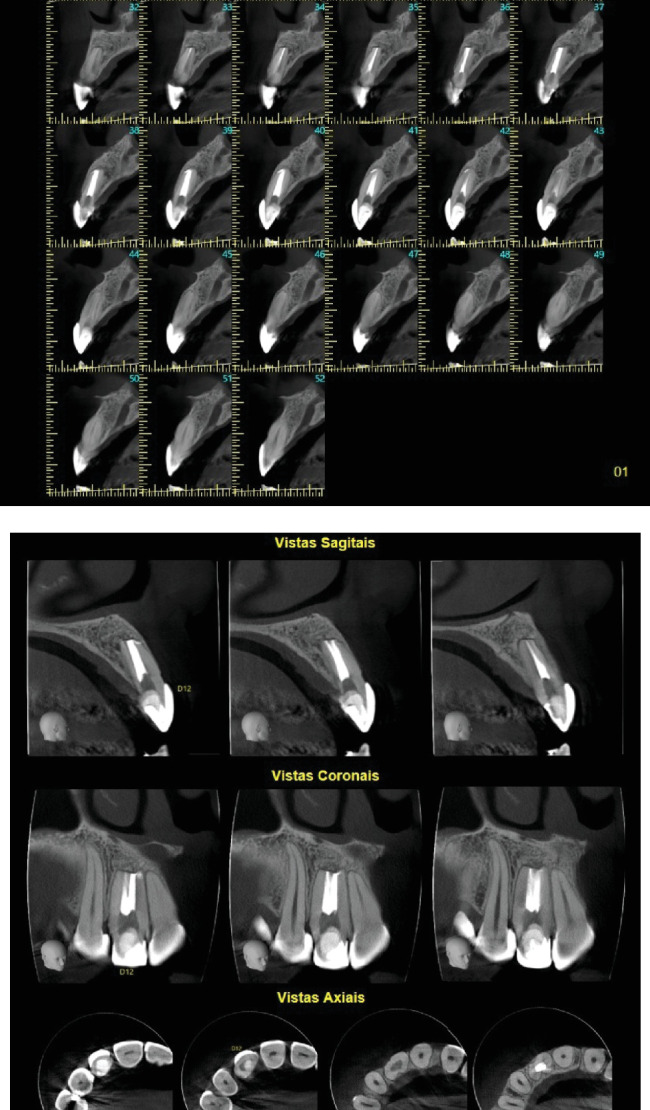 Figure 11