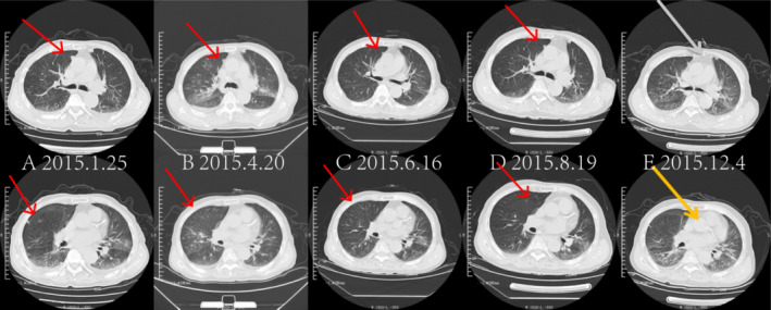 FIGURE 1