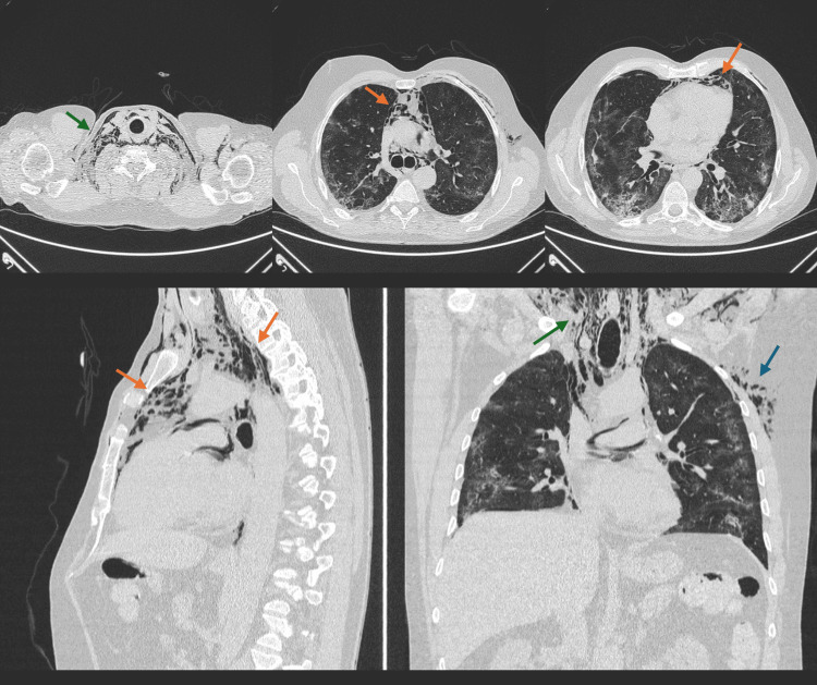 Figure 2