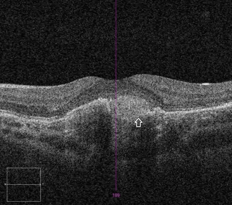 Figure 6
