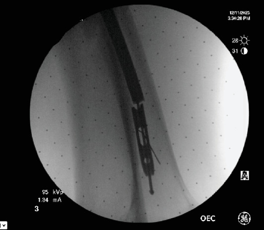 Figure 5