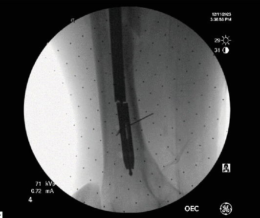 Figure 7