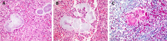FIGURE 1
