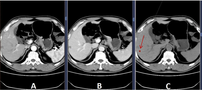 Figure 1
