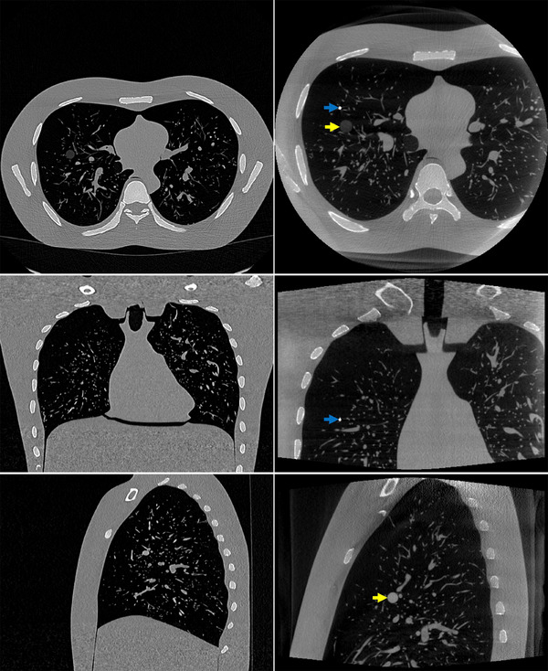 FIGURE 3