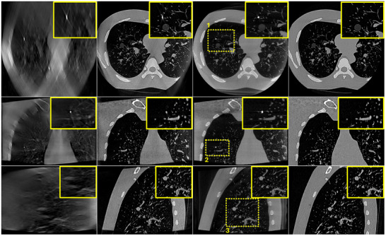 FIGURE 6