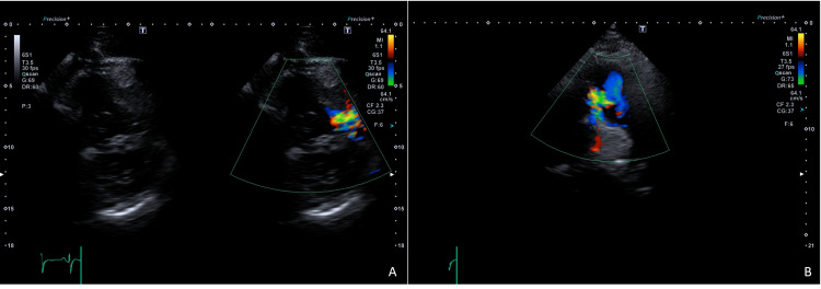 Figure 2