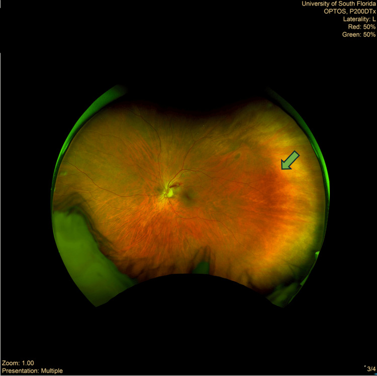 Figure 4