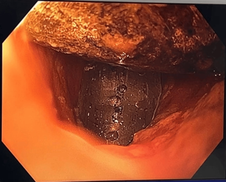 Figure 7