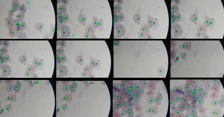 Figure 14