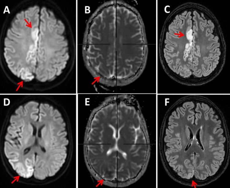 Figure 6