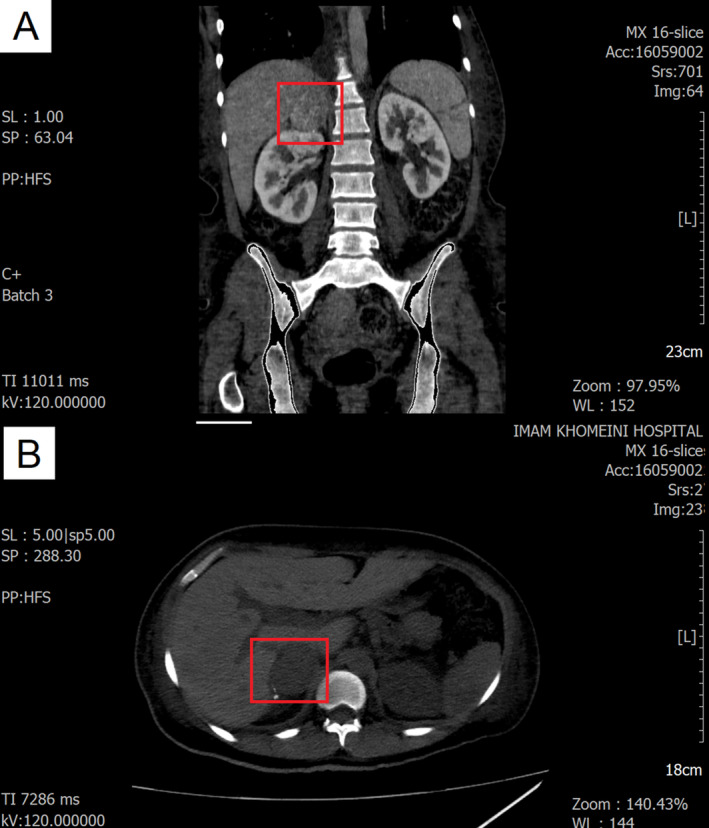 FIGURE 1