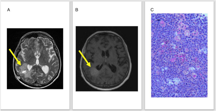 FIGURE 1