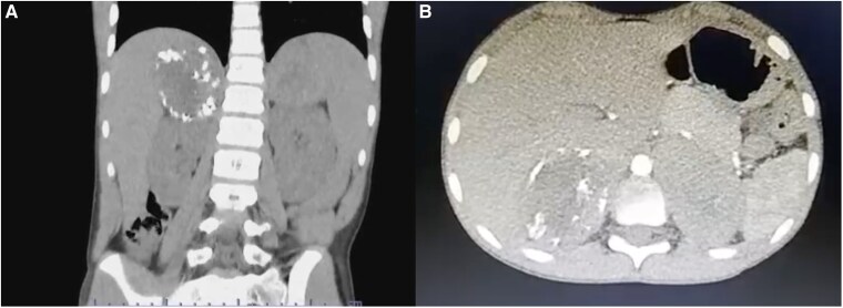 Figure 2