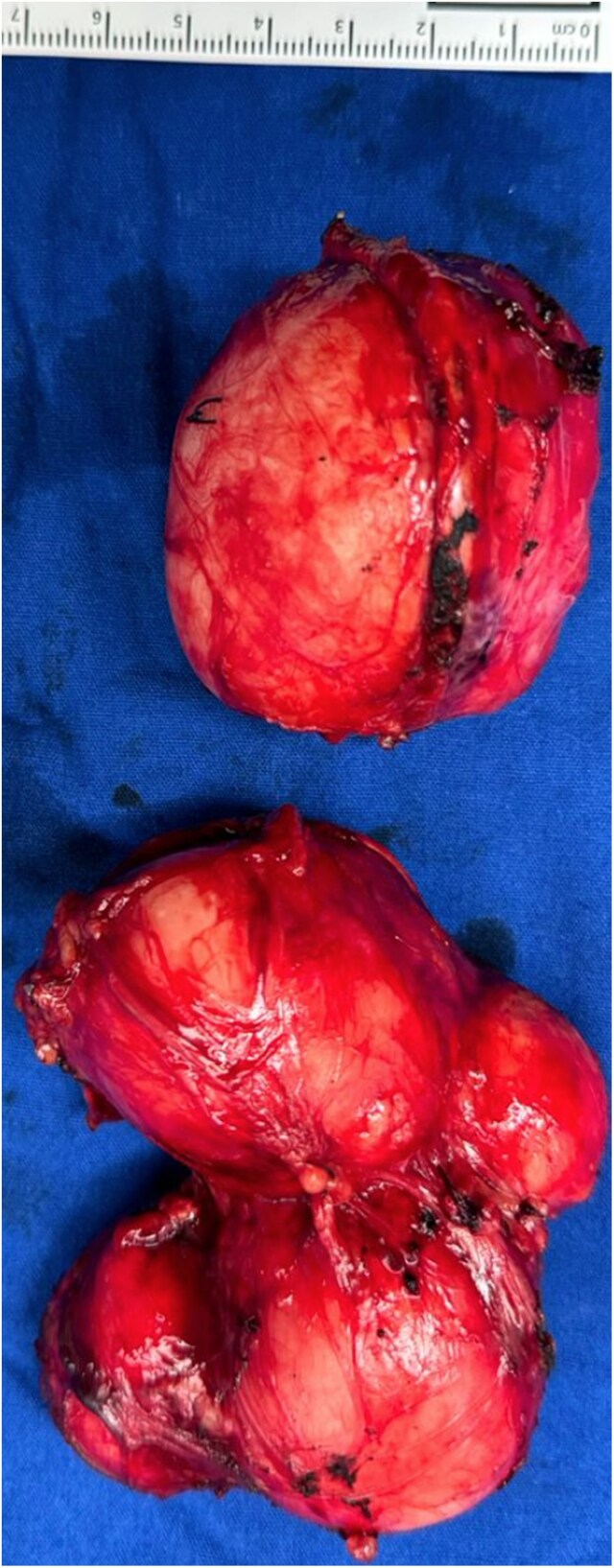 Figure 3