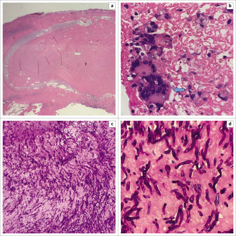 FIGURE 3