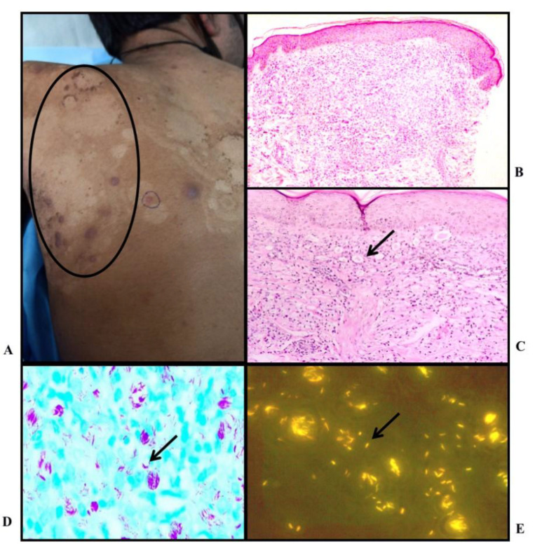 Fig. 6