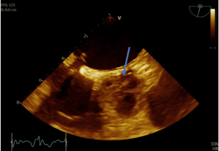 Figure 5