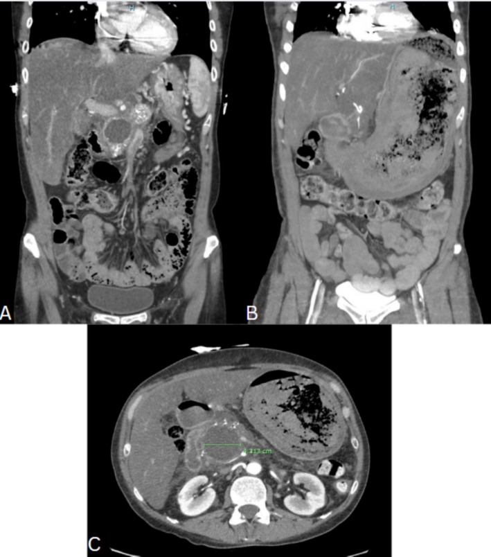 FIGURE 1