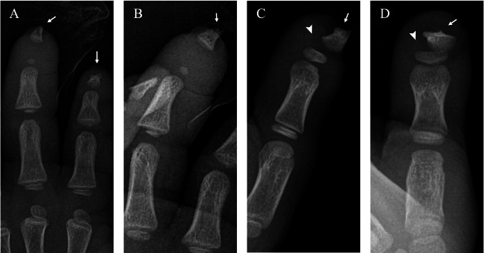 Figure 12