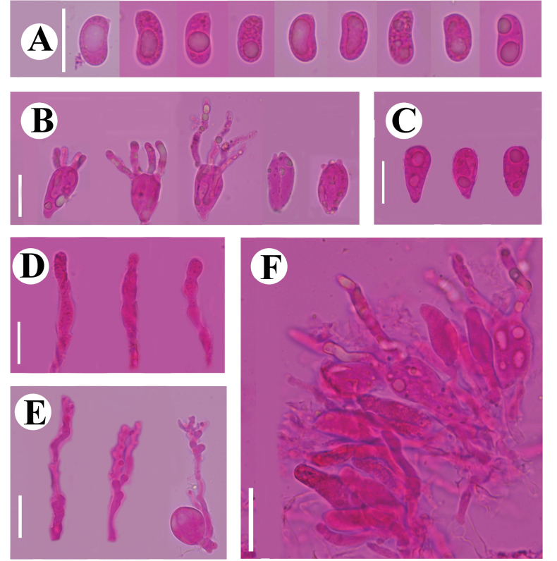 Figure 14