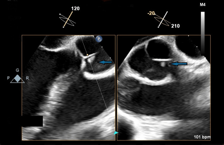 Figure 5