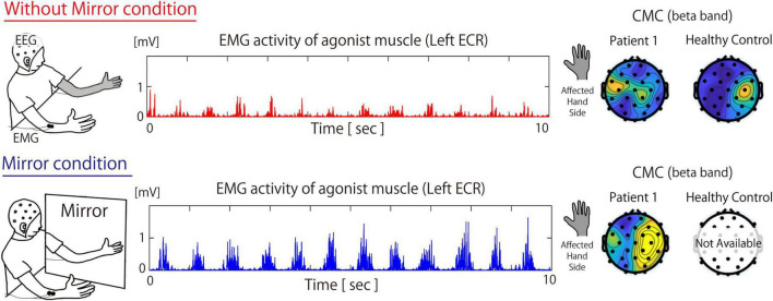 FIGURE 1