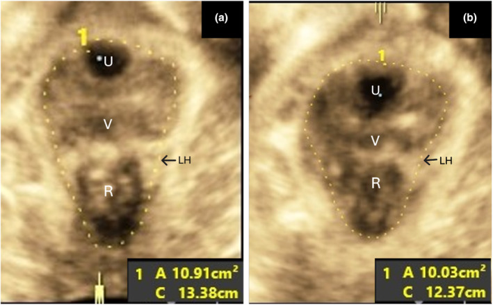 FIGURE 1