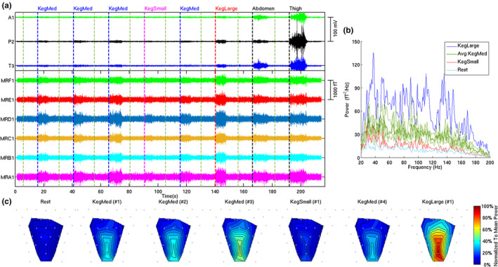 FIGURE 3