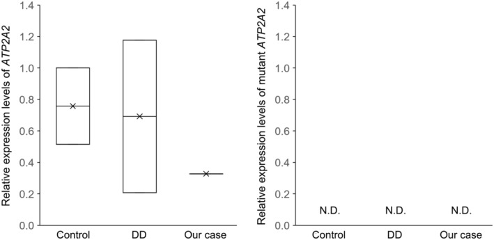 FIGURE 3
