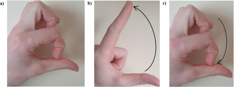 Fig 1