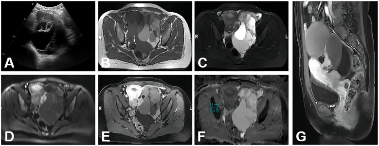 Figure 2